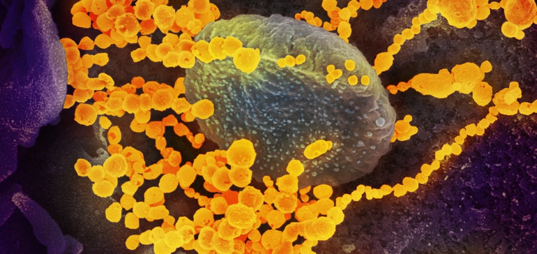 6a2ac3b32ebed876014591970de17106